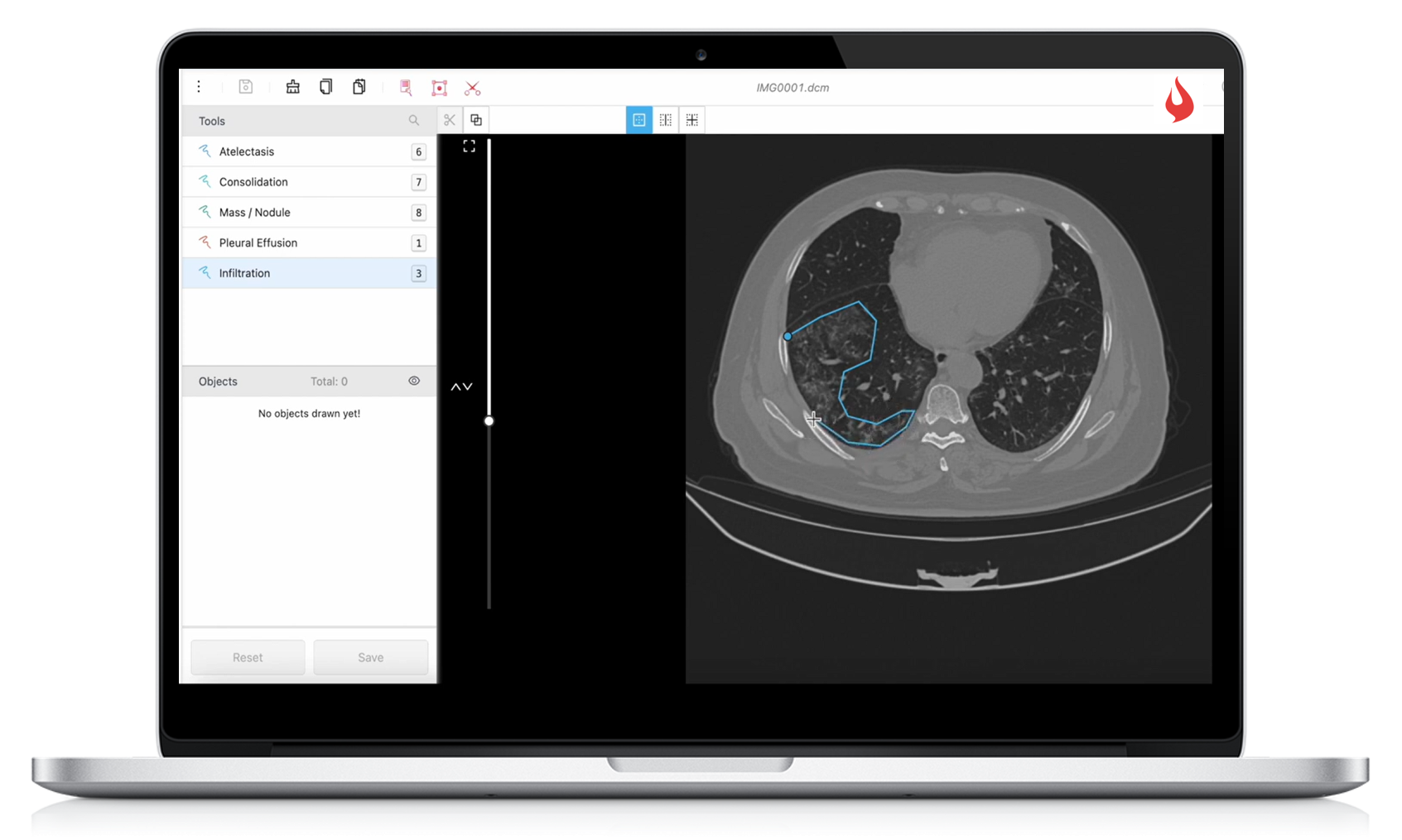 Digital Radiology Image