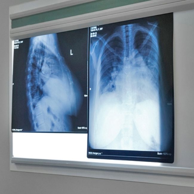 Medical Data Annotation and the Future of Healthcare - iMerit