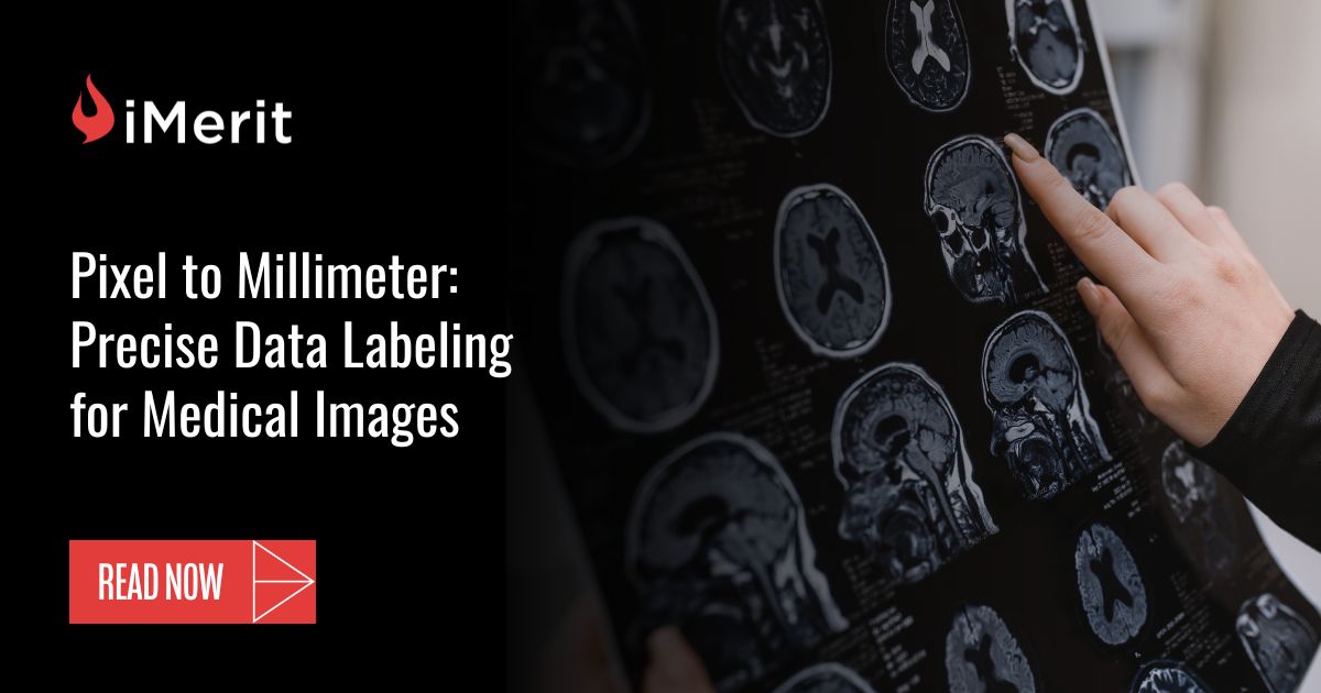 Pixel to Millimeter: Precise Data Labeling for Medical Images - iMerit