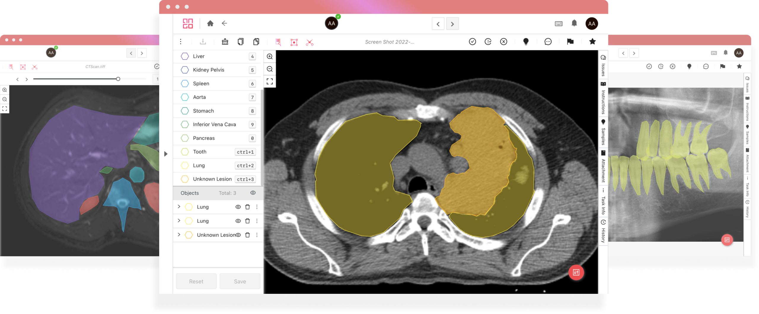 Annotated CT and X-ray scans for medical AI training.