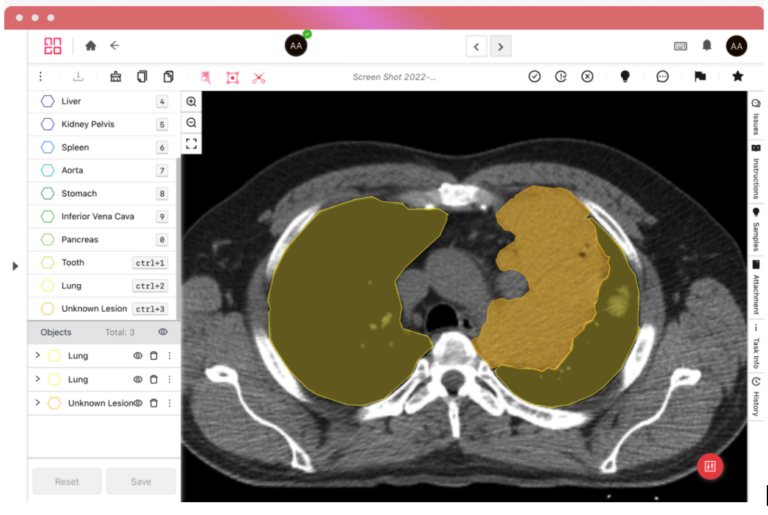 Medical Annotation Numbers Medical Image Annotation: A Complete Guide for Healthcare AI