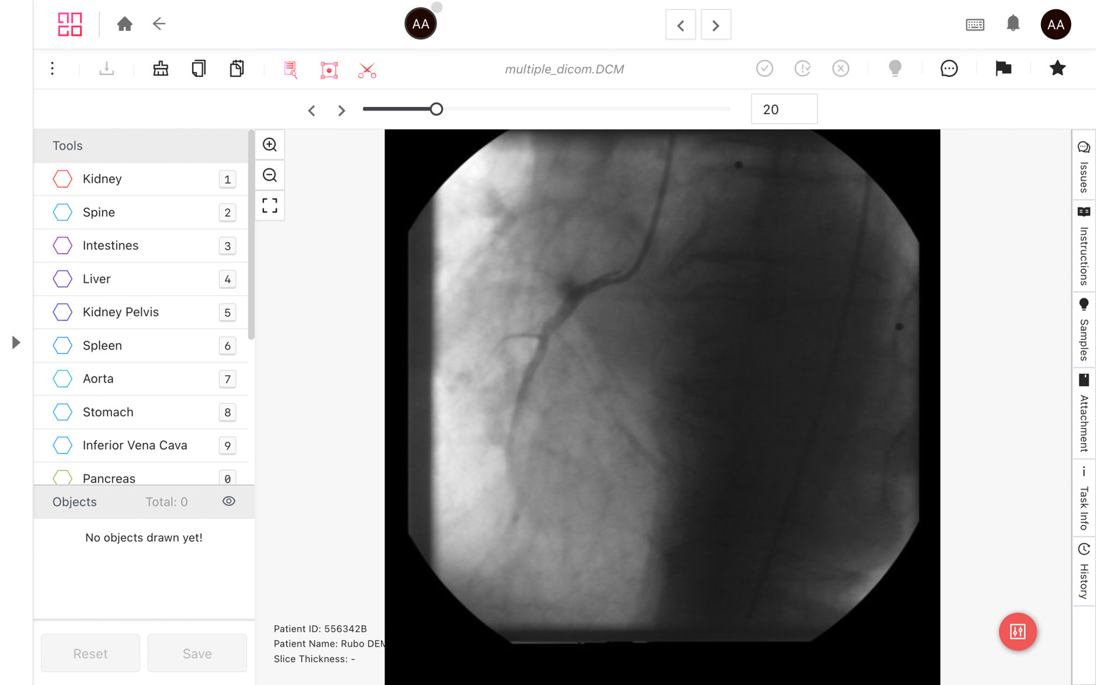 Top Tools for DICOM Annotation: A Comprehensive Guide (2025)