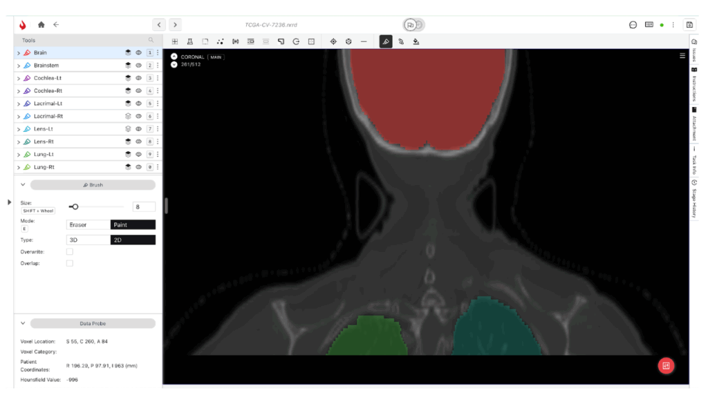 Top 5 Tools for Medical Image Annotation in 2025