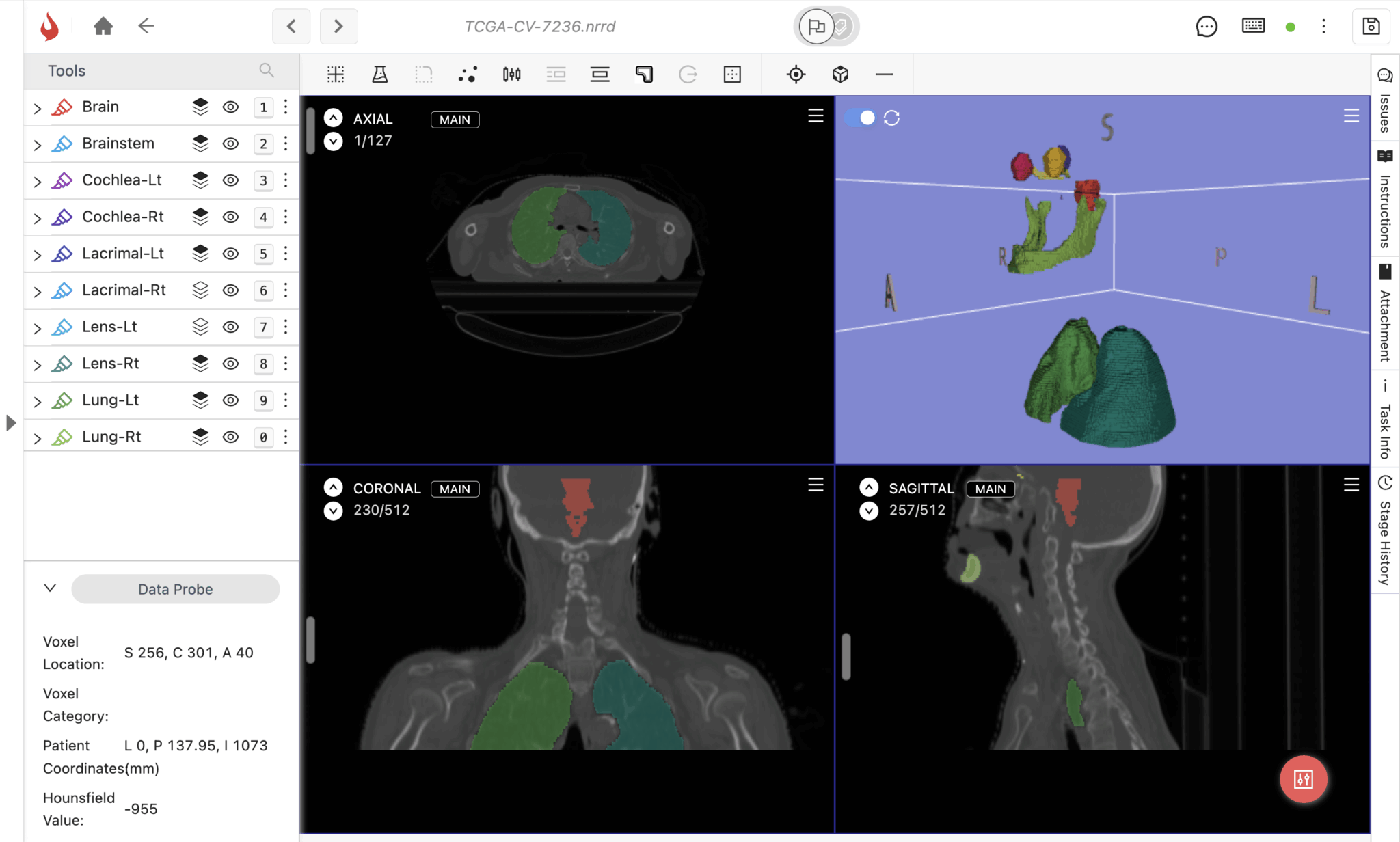 Medical Image Annotation Tools 2025