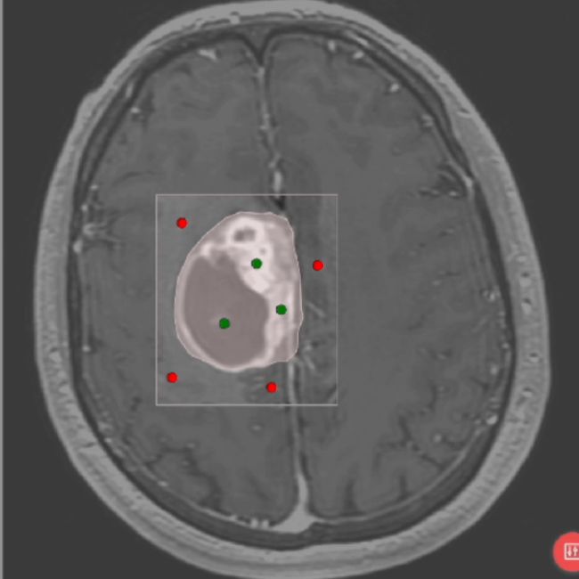 Neuro Triage