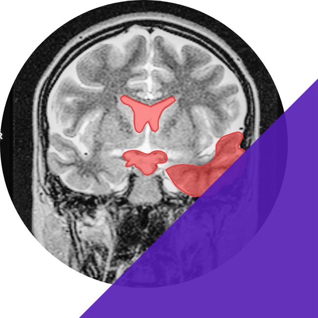 DICOM Annotation